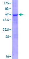 ab166048 on a 12.5% SDS-PAGE stained with Coomassie Blue.