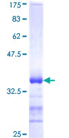 ab166049 on a 12.5% SDS-PAGE stained with Coomassie Blue.