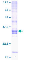 ab153306 on a 12.5% SDS-PAGE stained with Coomassie Blue.