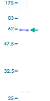 ab158721 on a 12.5% SDS-PAGE stained with Coomassie Blue.