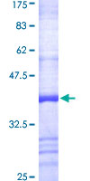 ab158722 on a 12.5% SDS-PAGE stained with Coomassie Blue.