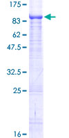 ab162538 on a 12.5% SDS-PAGE stained with Coomassie Blue.