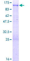 ab158724 on a 12.5% SDS-PAGE stained with Coomassie Blue.