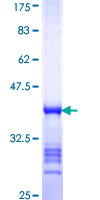 ab158726 on a 12.5% SDS-PAGE stained with Coomassie Blue.
