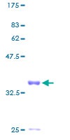 ab158482 on a 12.5% SDS-PAGE stained with Coomassie Blue.