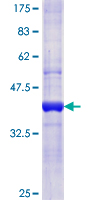 12.5% SDS-PAGE analysis of ab152473 stained with Coomassie Blue.