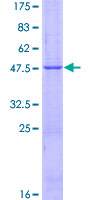 ab158727 on a 12.5% SDS-PAGE stained with Coomassie Blue.