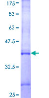 ab158729 on a 12.5% SDS-PAGE stained with Coomassie Blue.