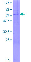 ab158741 on a 12.5% SDS-PAGE stained with Coomassie Blue.