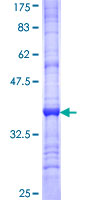 ab160072 on a 12.5% SDS-PAGE stained with Coomassie Blue.