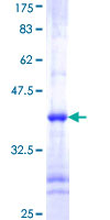 ab158121 on a 12.5% SDS-PAGE stained with Coomassie Blue.
