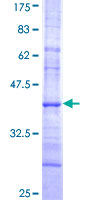 ab153006 on a 12.5% SDS-PAGE stained with Coomassie Blue.