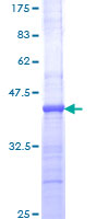 ab158755 on a 12.5% SDS-PAGE stained with Coomassie Blue.