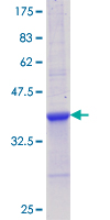 ab158760 on a 12.5% SDS-PAGE stained with Coomassie Blue.