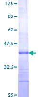 ab158761 on a 12.5% SDS-PAGE stained with Coomassie Blue.