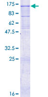 ab158762 on a 12.5% SDS-PAGE stained with Coomassie Blue.