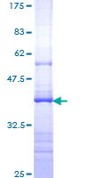 ab161762 on a 12.5% SDS-PAGE stained with Coomassie Blue.