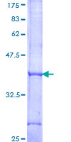ab163120 on a 12.5% SDS-PAGE stained with Coomassie Blue.