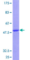 ab162110 on a 12.5% SDS-PAGE stained with Coomassie Blue.