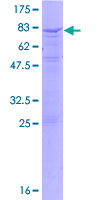 ab164665 on a 12.5% SDS-PAGE stained with Coomassie Blue.