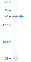 12.5% SDS-PAGE Stained with Coomassie Blue.