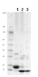 1D SDS-PAGE of ab85600 before and after treatment with glycosidases to remove oligosaccharides. Lane 1: ab85600 Lane 2: ab85600 treated with PNGase F to remove potential N-linked glycans Lane 3: ab85600 treated with a glycosidase cocktail to remove potential N- and O-linked glycans. Approximately 5 µg of protein was loaded per lane; Gel was stained using Coomassie. Drop in MW after treatment with PNGase F indicates presence of N-linked glycans. Additional bands in lane 2 and lane 3 are glycosidase enzymes.