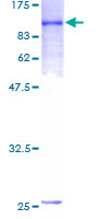 12.5% SDS-PAGE stained with Coomassie Blue showing ab132008 at approximately 84.92 kDa.