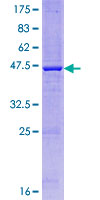 ab162592 on a 12.5% SDS-PAGE stained with Coomassie Blue.
