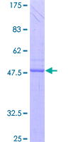 ab153149 on a 12.5% SDS-PAGE stained with Coomassie Blue.