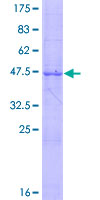 ab153150 on a 12.5% SDS-PAGE stained with Coomassie Blue.