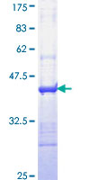 ab153151 on a 12.5% SDS-PAGE stained with Coomassie Blue.