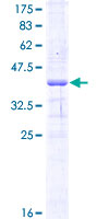 ab165762 on a 12.5% SDS-PAGE stained with Coomassie Blue.