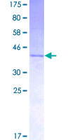 ab158756 on a 12.5% SDS-PAGE stained with Coomassie Blue.