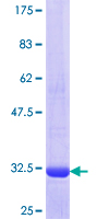 ab153290 on a 12.5% SDS-PAGE stained with Coomassie Blue.