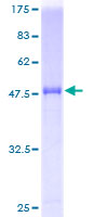 ab153288 on a 12.5% SDS-PAGE stained with Coomassie Blue.