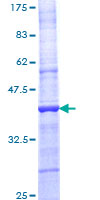 ab158757 on a 12.5% SDS-PAGE stained with Coomassie Blue.