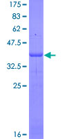 ab158758 on a 12.5% SDS-PAGE stained with Coomassie Blue.