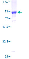 ab164306 on a 12.5% SDS-PAGE stained with Coomassie Blue.