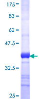 ab164307 on a 12.5% SDS-PAGE stained with Coomassie Blue.