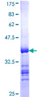 ab164973 on a 12.5% SDS-PAGE stained with Coomassie Blue.