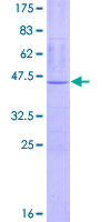 ab165833 on a 12.5% SDS-PAGE stained with Coomassie Blue.