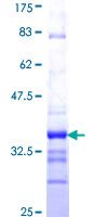 ab164472 on a 12.5% SDS-PAGE stained with Coomassie Blue.