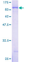 ab153106 on a 12.5% SDS-PAGE stained with Coomassie Blue.