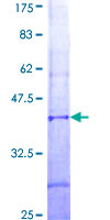 ab165748 on a 12.5% SDS-PAGE stained with Coomassie Blue.