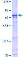 ab163086 on a 12.5% SDS-PAGE stained with Coomassie Blue.