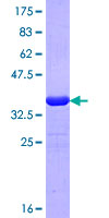 ab153096 on a 12.5% SDS-PAGE stained with Coomassie Blue.