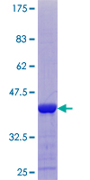 ab166532 on a 12.5% SDS-PAGE stained with Coomassie Blue.