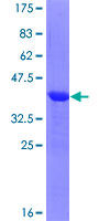 ab158763 on a 12.5% SDS-PAGE stained with Coomassie Blue.
