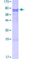 ab158764 on a 12.5% SDS-PAGE stained with Coomassie Blue.