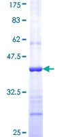 ab158765 on a 12.5% SDS-PAGE stained with Coomassie Blue.